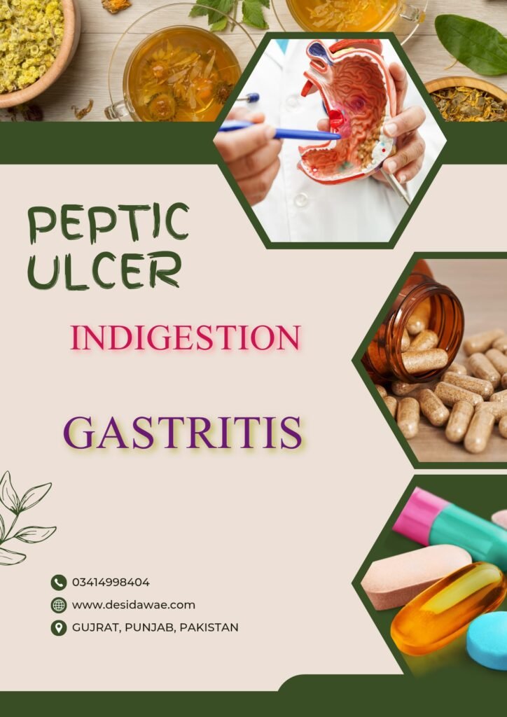 Peptic ulcer indigestion Gastritis